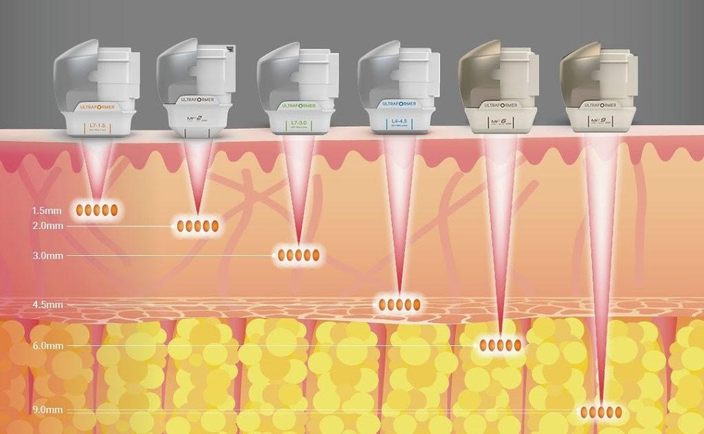 Explicación accesorio aparatología Tecno UltraLift